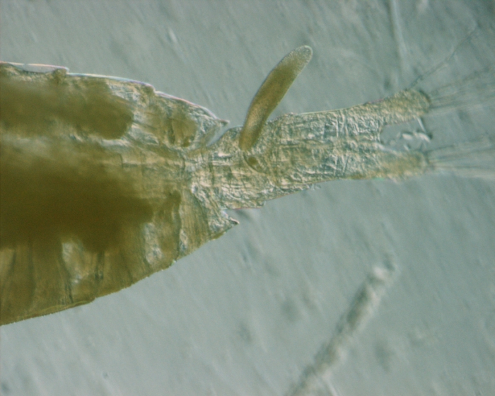 Calanus hyperboreus, higher mag, 8x Calanus hyperboreus, higher mag, 8x