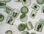 Diatoms