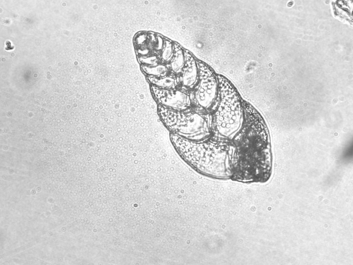 Bolivina sp. Bolivina sp.