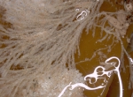 Bryozoans
