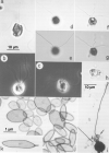 Chrysochromulina polylepis