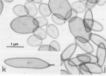 Chrysochromulina polylepis, author: Larsen, Jacob