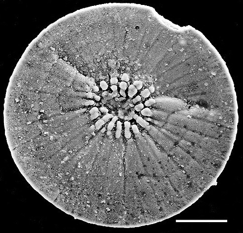 Pileolina gracei NZ holotype Pileolina gracei NZ holotype