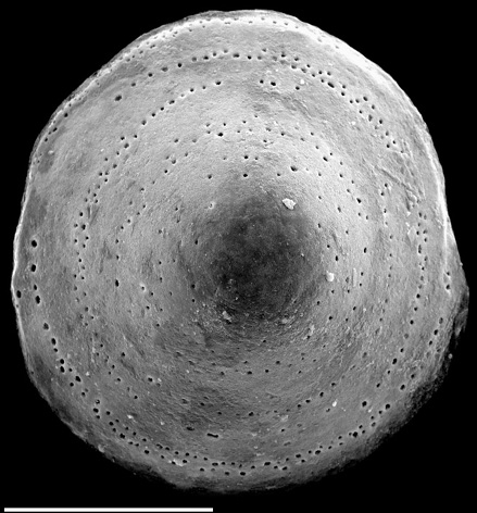 Pileolina gracei NZ paratype Pileolina gracei NZ paratype
