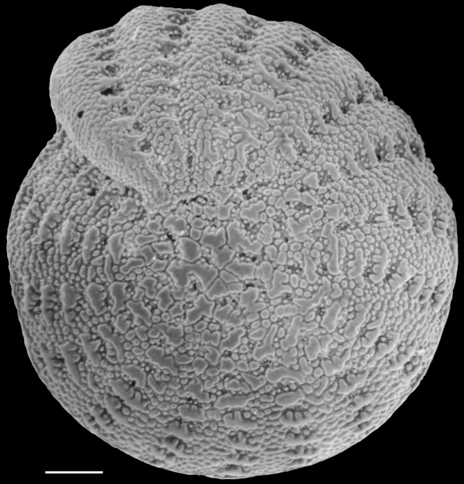 Elphidium collinsi New South Wales, holotype Elphidium collinsi New South Wales, holotype