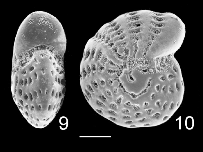 Elphidium fijiense Fiji holotype