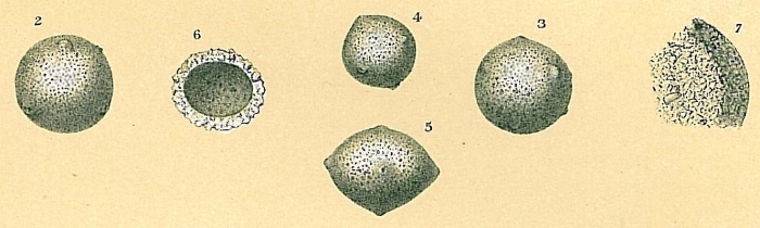 Thurammina albicans Thurammina albicans