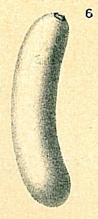 Parafissurina botelliformis Parafissurina botelliformis