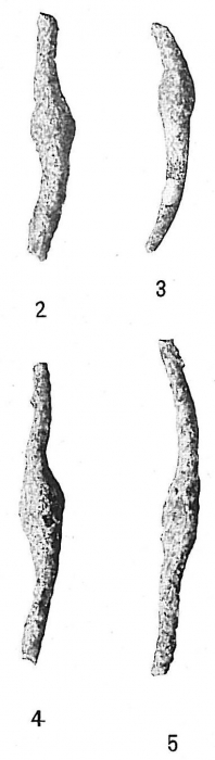 Rhabdammina linearis Rhabdammina linearis