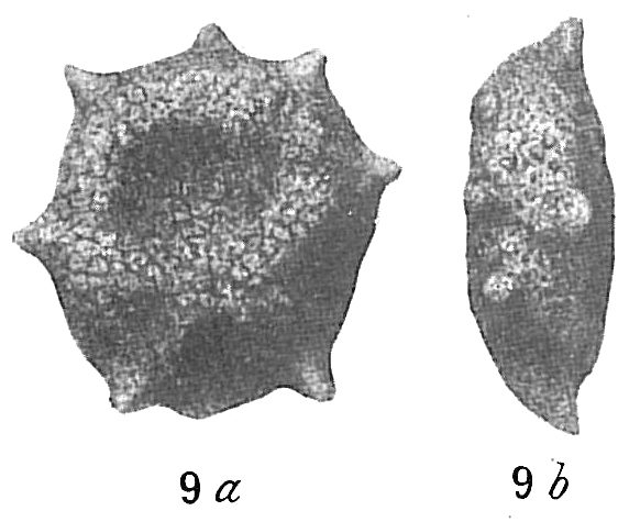 Thurammina compressa Thurammina compressa