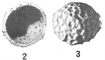 Thurammina favosa
