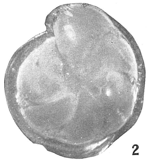 Cristellaria lucida Cristellaria lucida