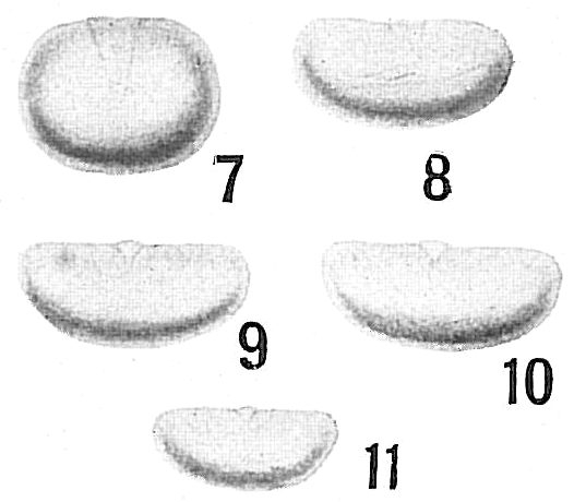 Lagena reniformis Lagena reniformis