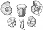 Anomalina coronata