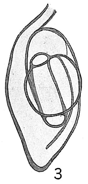 Spiroloculina grateloupi Spiroloculina grateloupi