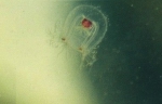 Hydrozoa