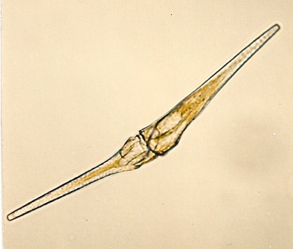 Ceratium fusus Ceratium fusus