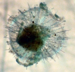 Aulacanthidae, author: Fisheries and Oceans Canada, Moira Galbraith