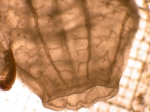 Ctenophores