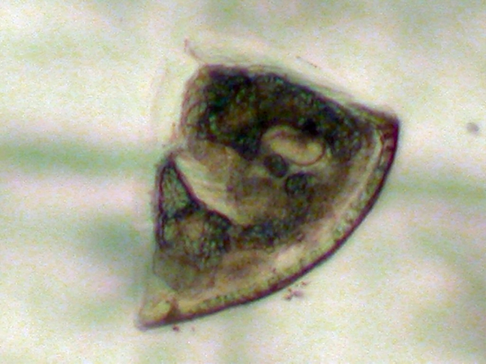 Bryozoa