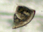 Bryozoans
