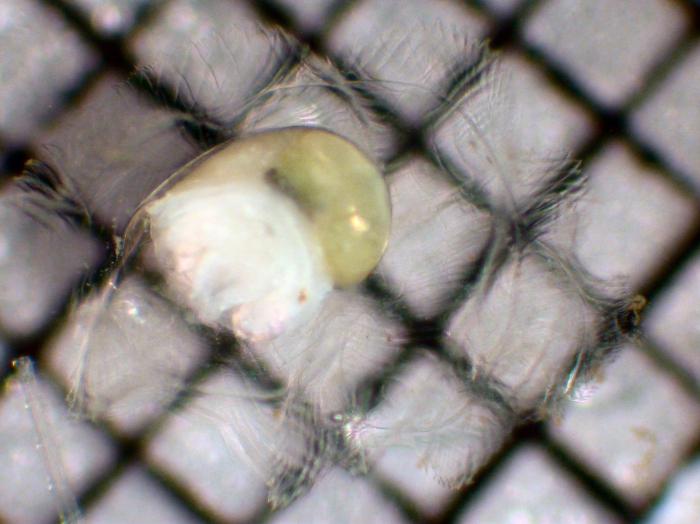 Gastropoda Gastropoda