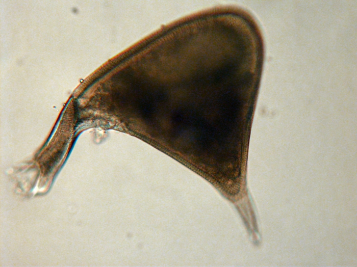 Phaeodarea Phaeodarea
