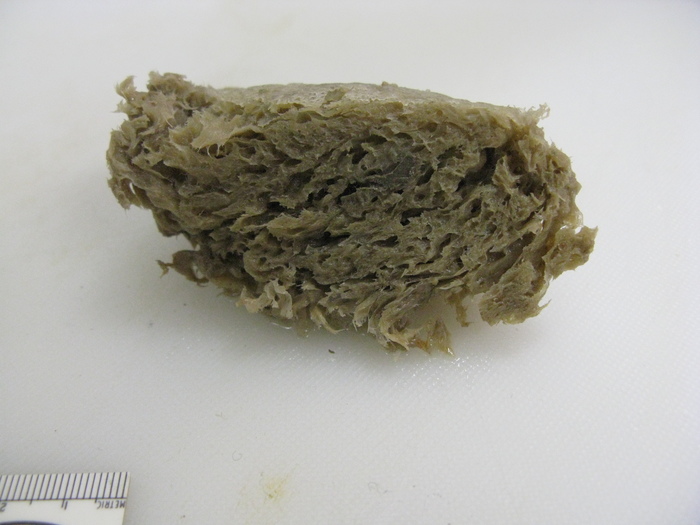 Hamacantha carteri Hamacantha carteri