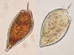 Dinoflagellates