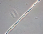 Diatoms