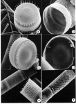 Lake Winnipeg phytoplankton plates