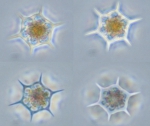 Flagellates and Ciliates
