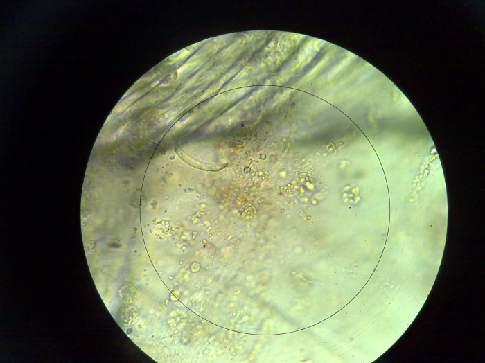 Coccolithophore
