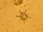 Phytoplankton