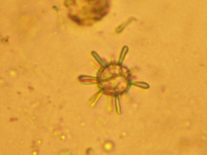 Rhabdosphaera claviger