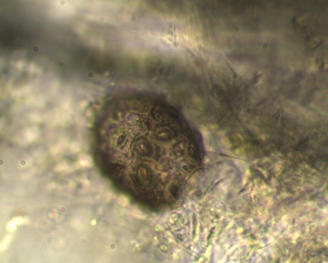 Coccolithophore Coccolithophore