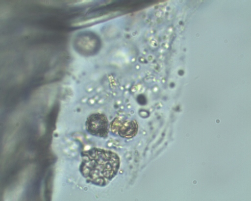 Coccolithophores Coccolithophores