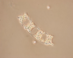 Eucampia zoodiacus, author: Fisheries and Oceans Canada, Dalhousie University, Rajashree Gouda