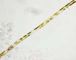 Phytoplankton