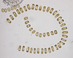 Phytoplankton