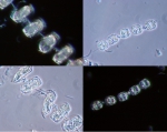 Phytoplankton