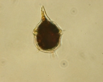 Dinoflagellates