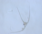 Phytoplankton