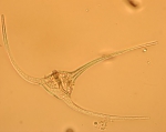 Ceratium arcticum, author: Fisheries and Oceans Canada, Dalhousie University, Rajashree Gouda