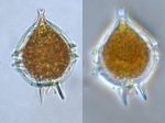 Protoperidinium steinii, author: Fisheries and Oceans Canada, Dalhousie University, Rajashree Gouda