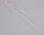 Phytoplankton