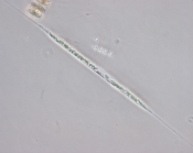 Rhizosolenia setigera