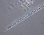 Diatoms