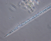 Rhizosolenia