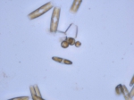 Phytoplankton